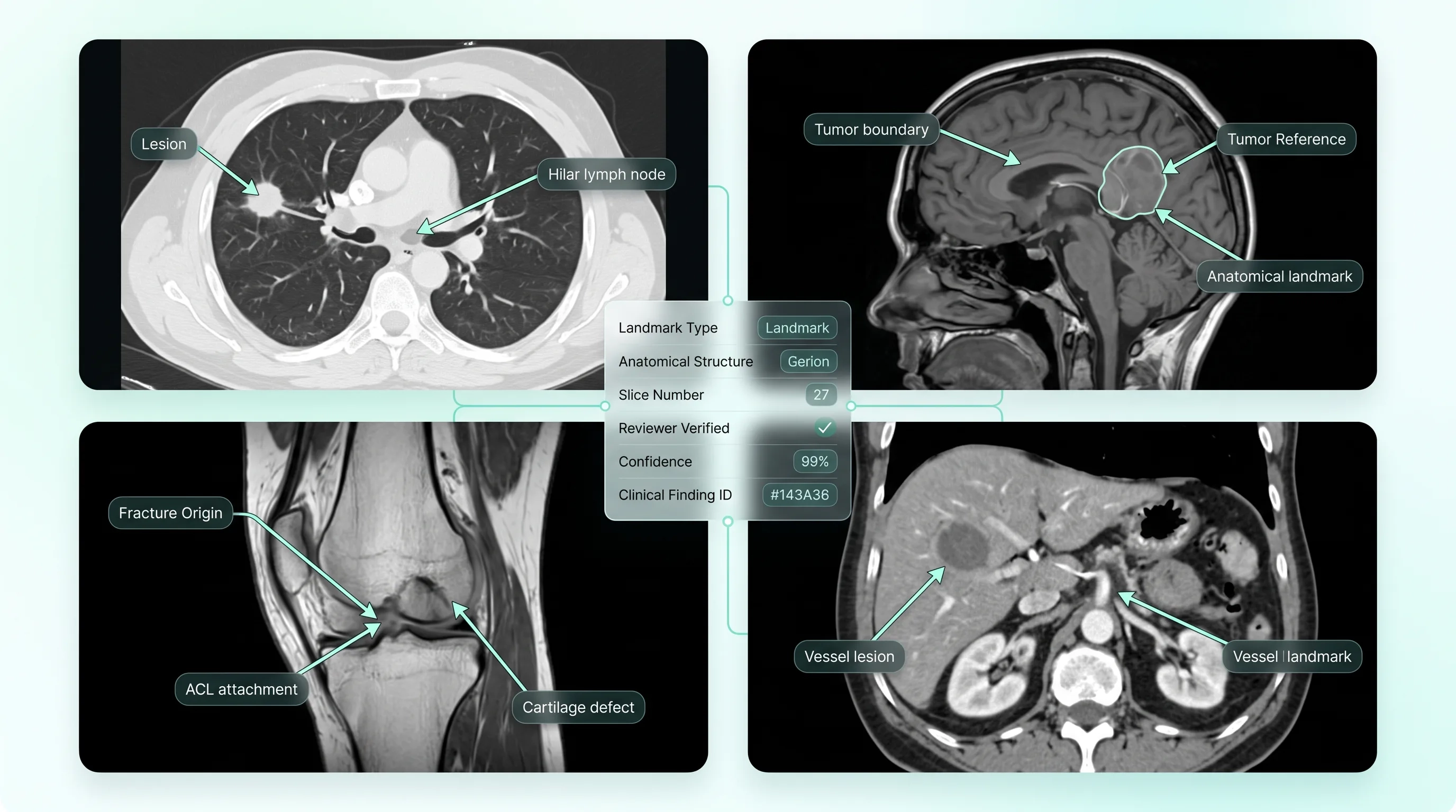 Landmark arrow annotation on medical imaging