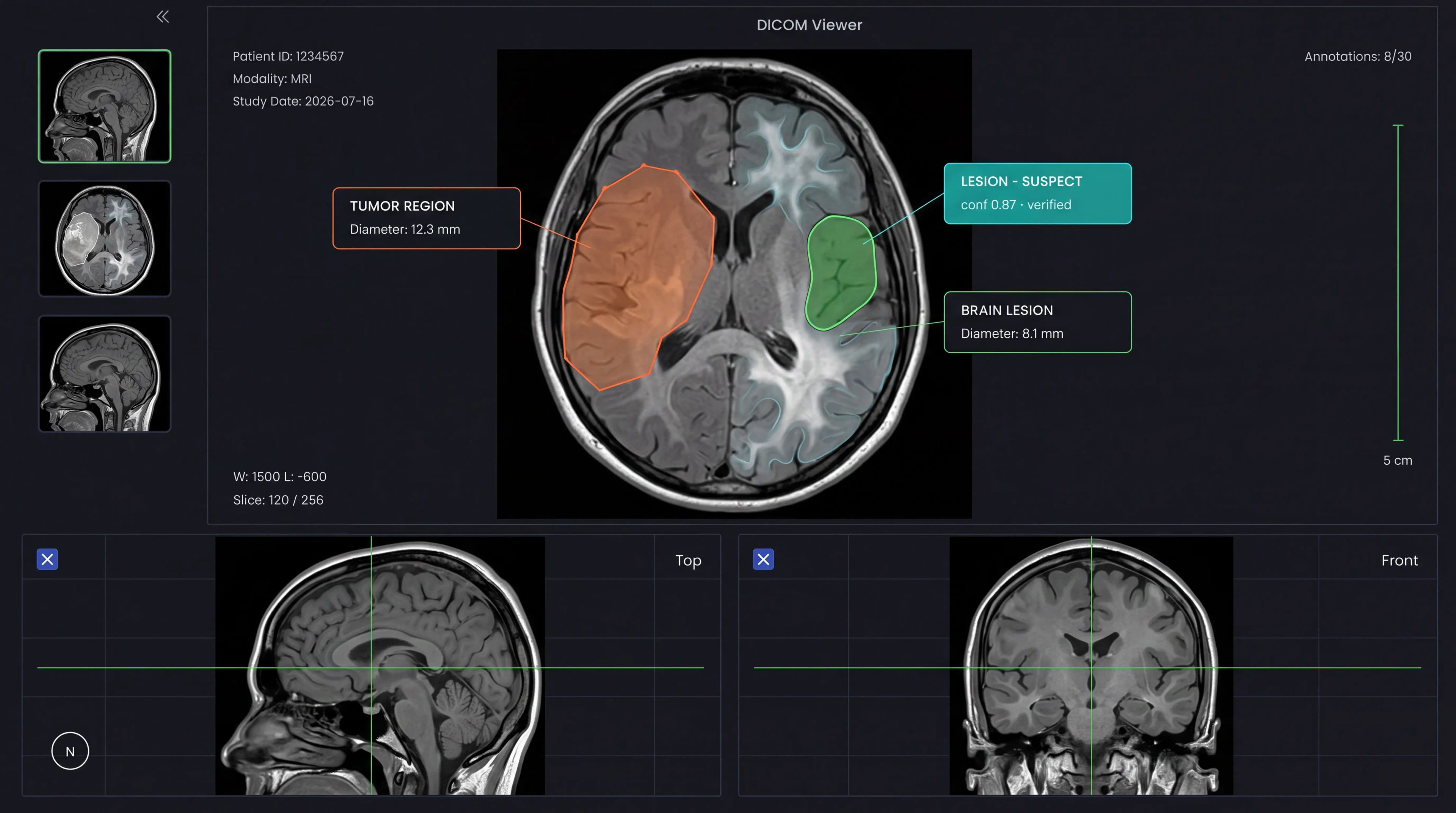 DICOM & Medical Imaging - governed annotation example