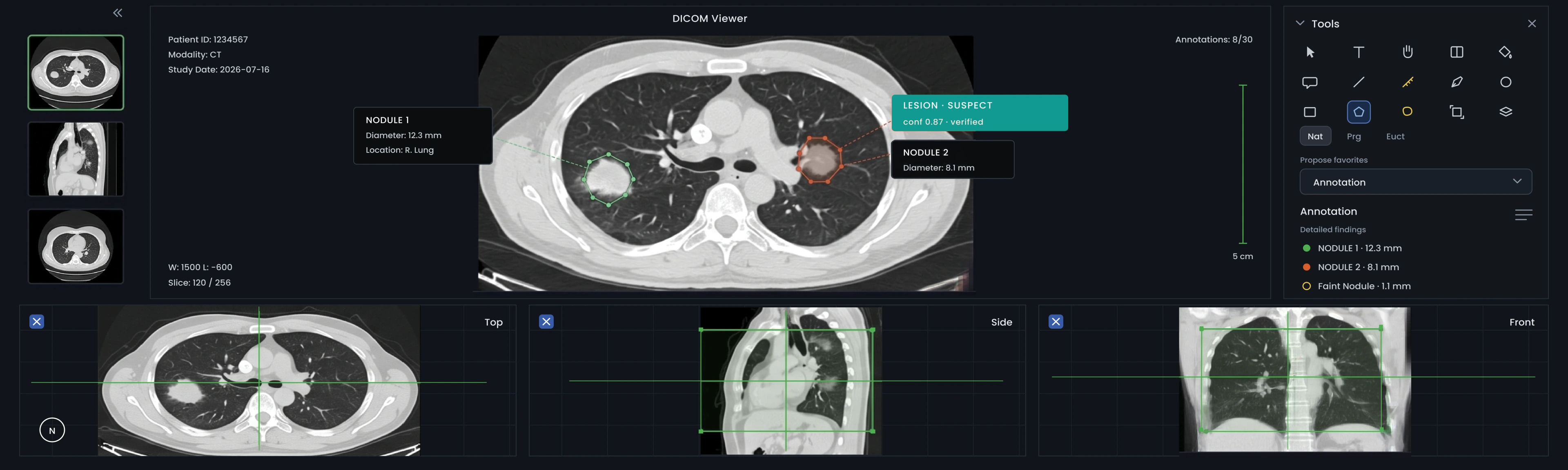 DICOM & Medical Imaging - governed annotation example